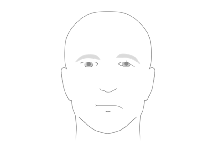 Illustration af et ansigt, hvor den ene side hænger i mundvigen, kinden og øjenlåget.