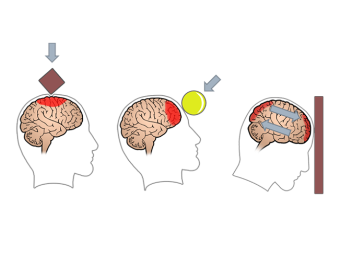 Illustration af tre slags beskadigelse af hjernen. 1: en spids genstand falder ned i toppen af hovedet. 2. En rund genstand rammer foran i hovedet. 3. et hoved banker panden mod en mur. 